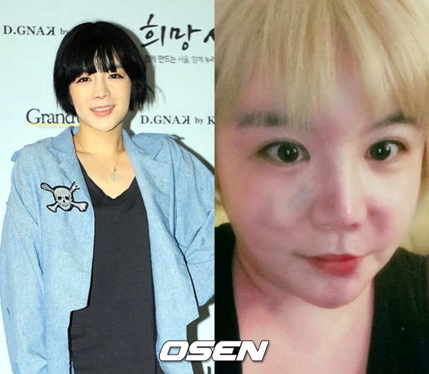 "얼굴에 멍+90kg"...에이미, 급격한 외모 변화에 &apos;충격&apos;(종합)[Oh!쎈 이슈]