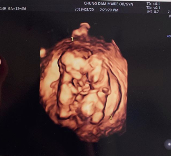 율희 인스타그램