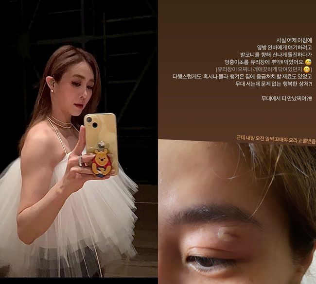 옥주현, 유리창에 부딪혀 눈 부상..“무대에서 티 안났죠?”