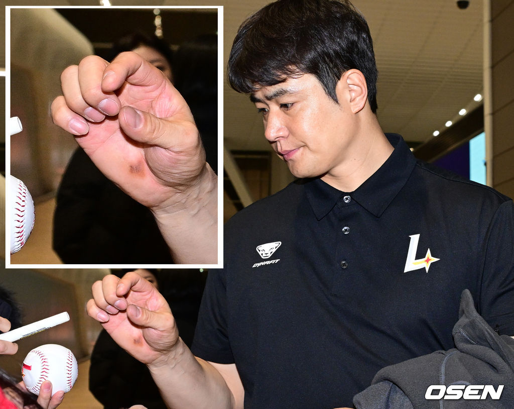스프링캠프 출국을 앞두고 포착된 물집과 굳은살이 박힌 김재환의 손바닥.