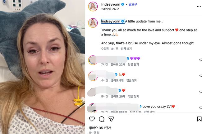 ‘스키 여제’ 린지 본(41, 미국)이 수술 소식과 팬들 향한 감사 인사를 전했다. / 린지 본 SNS