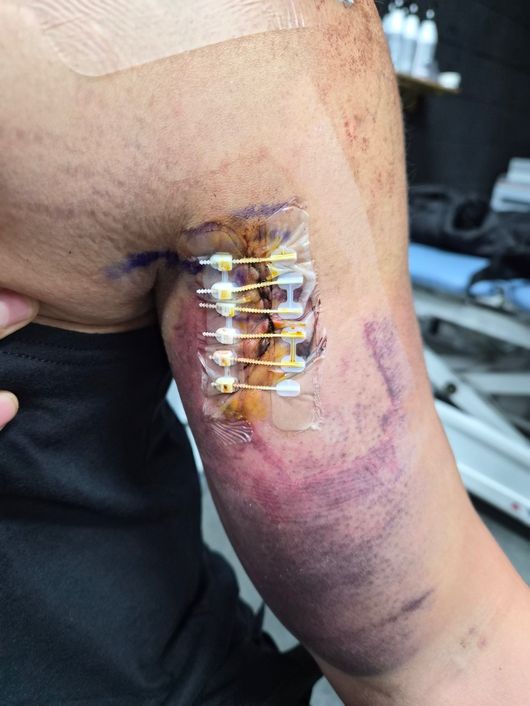 어깨 수술을 받은 추신수의 모습. / 노경은, 추신수 제공