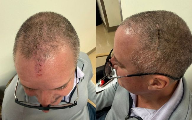 [사진] 마크 투세이커 SNS